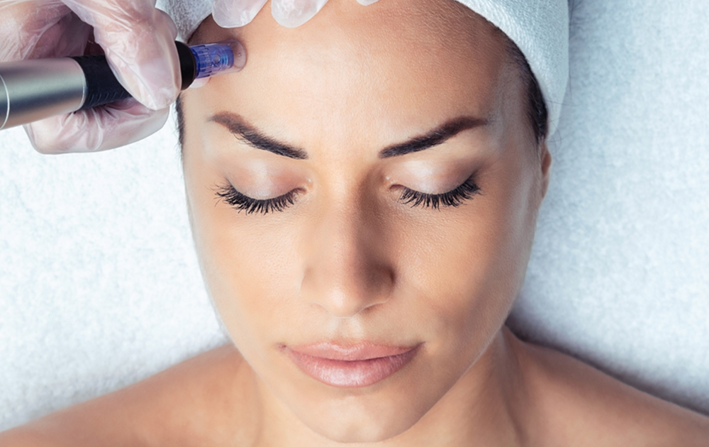 Menu_Cytopen Microneedling
