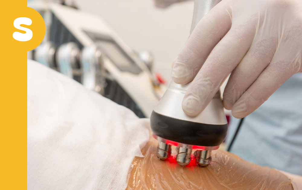 RF Skin Tightening (Single Session)