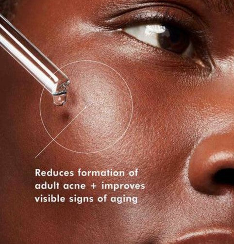 Blemish + Age Defense